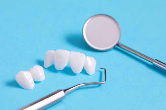 セラミックの歯と治療用具