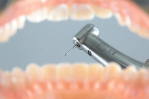 虫歯を治療するイメージ