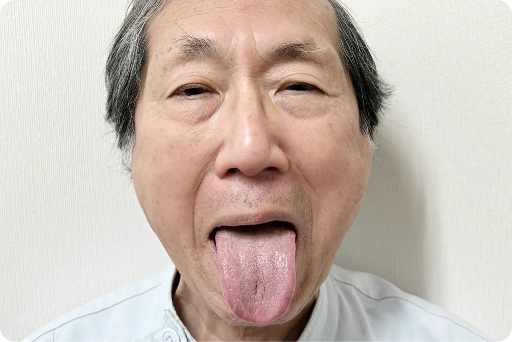 kourinshika-hypofunction_treatment_03