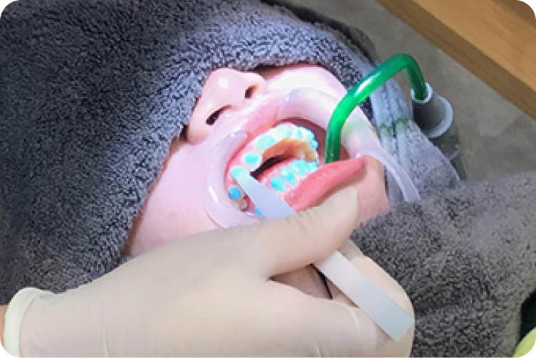 kourinshika-whitening_flow_05