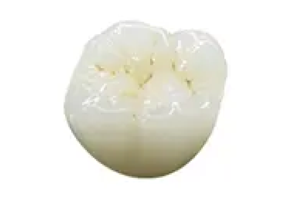 kourinshika-aesthetic-zirconia