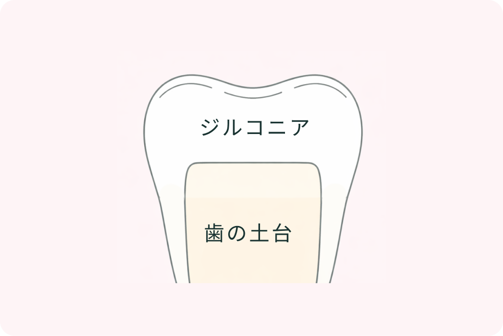 kourinshika-aesthetic-zirconia_type_01