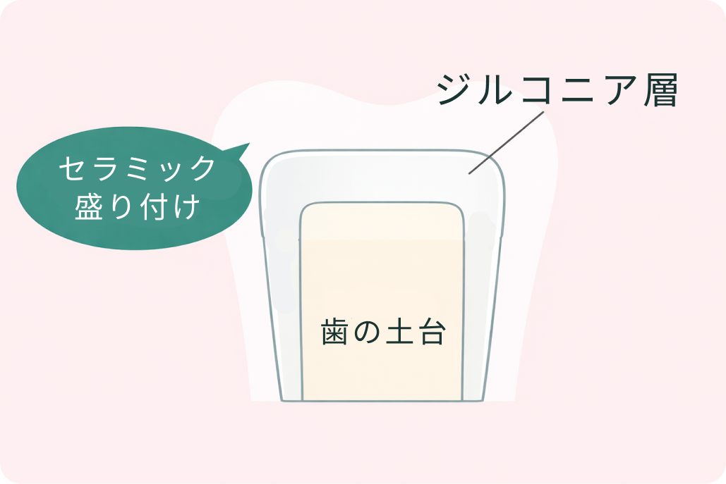 kourinshika-aesthetic-zirconia_type_02
